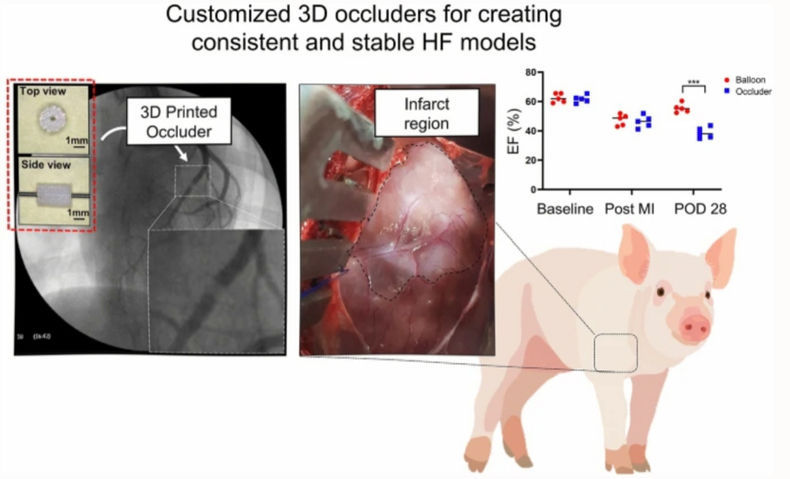 돼지 심근경색 모델 제작용 맞춤형 3D 프린팅 폐색기. 만성 심근경색 모델을 유발시킬 수 있는 획기적인 도구로 활용될 수 있다. 2021.08.02 (출처:POSTECH)