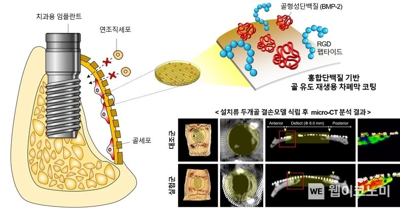 홍합단백질 기반 골 유도 재생용 차폐막 코팅 개발 모식도