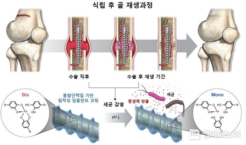 세균 감염에 의한 체내 환경 변화에 따라 즉각적인 항생체 방출이 가능한 기능성 임플란트 코팅 소재 모식도 / 2024.02.22 (출처: POSTECH)