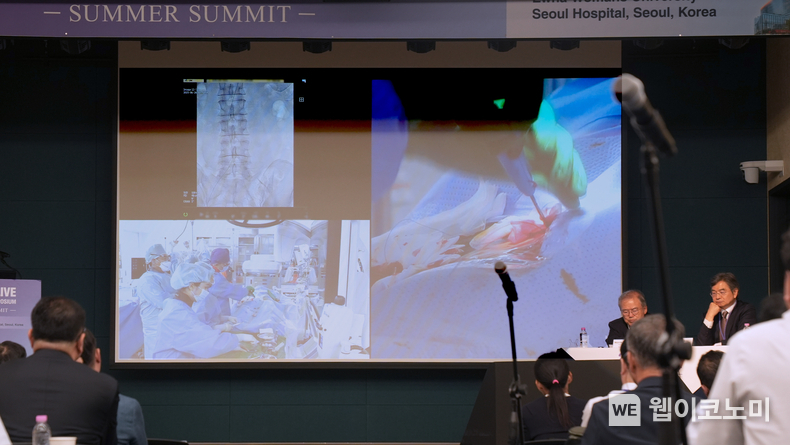 이대대동맥혈관병원 개원 2주년 기념식 및 E-Alive Summer Summit에서 송석원 이대대동맥혈관병원장이 라이브 서저리를 시연하고 있다. (출처: 이화의료원) / 2025. 06. 30
