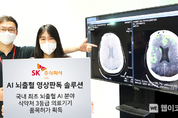SK㈜ C&C ‘AI 뇌출혈 영상판독 솔루션’, 국내 최초 뇌출혈 AI 분야 식약처 3등급 의료기기 품목허가 획득